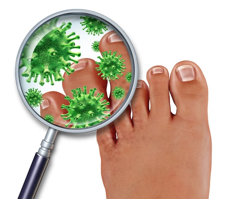 Foot fungal infection