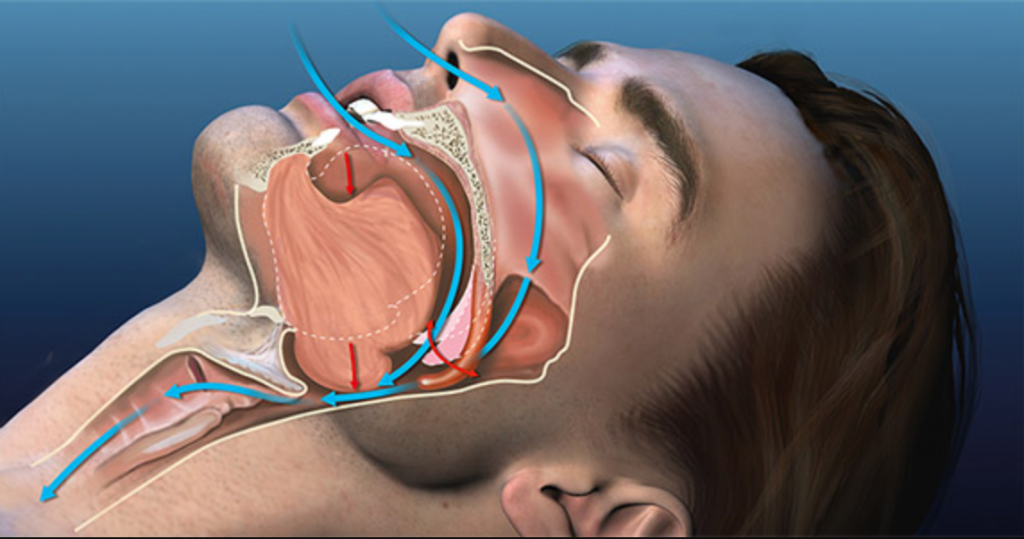 Airsnore reviews